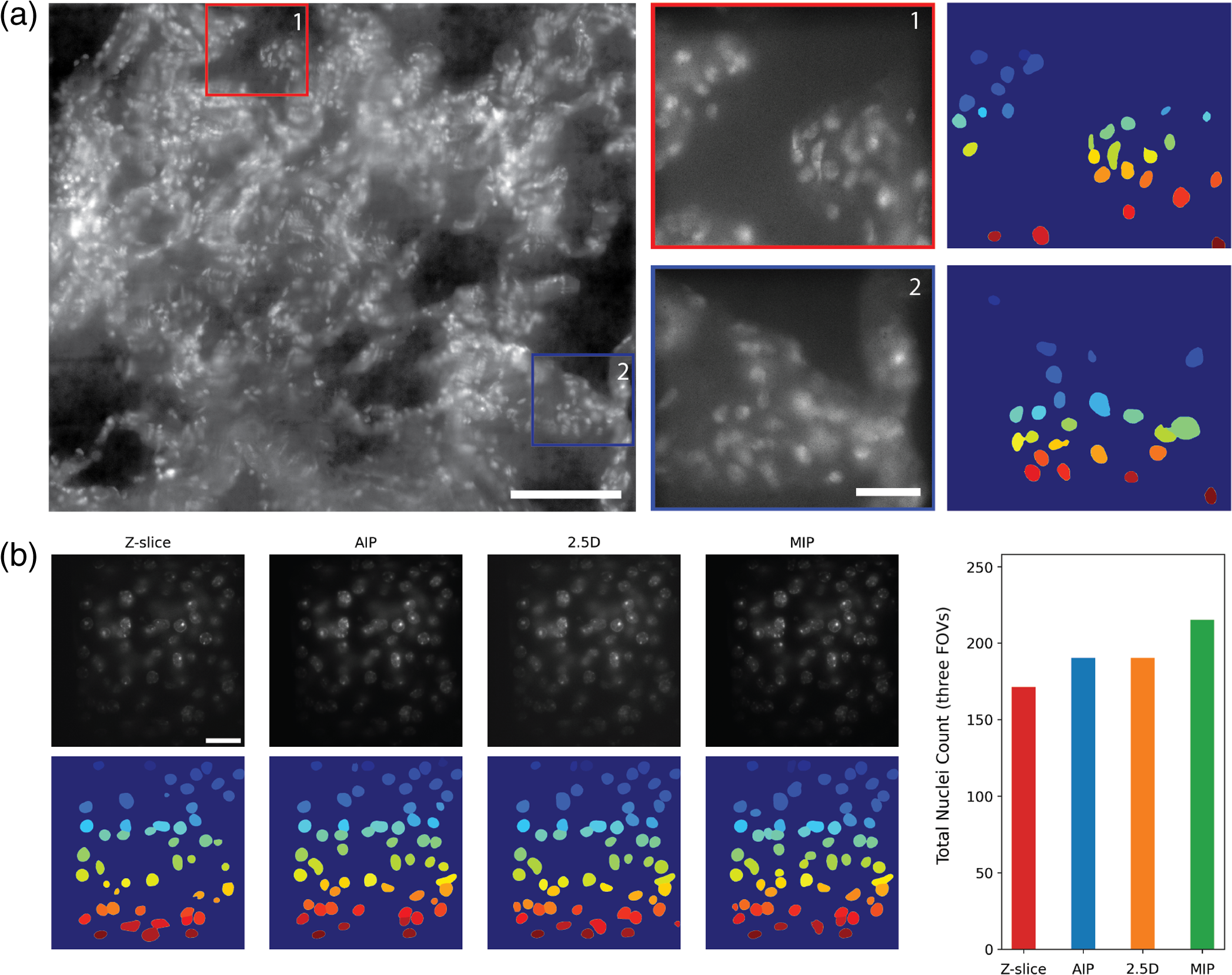 Double Ridge Micrograph Multiplane 2.5D microscopy for high-throughput high-resolution tissue ...