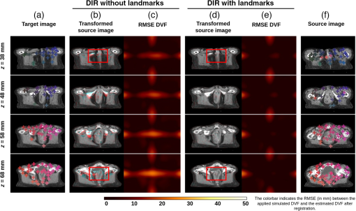 JMI_10_1_014007_f011.png